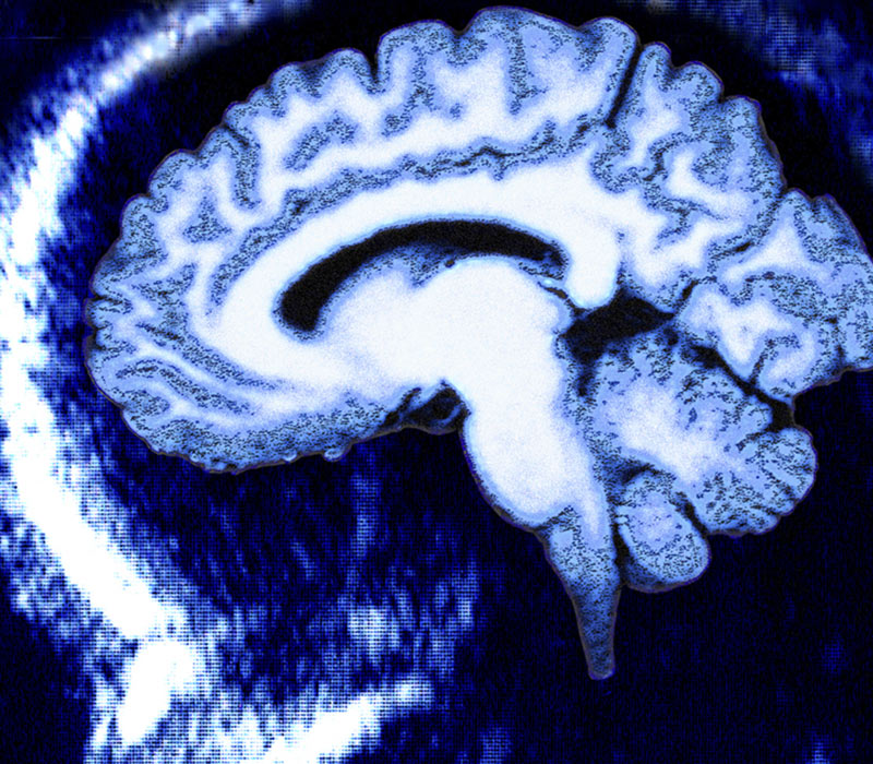 NeurosequentialModel of Therapeutics